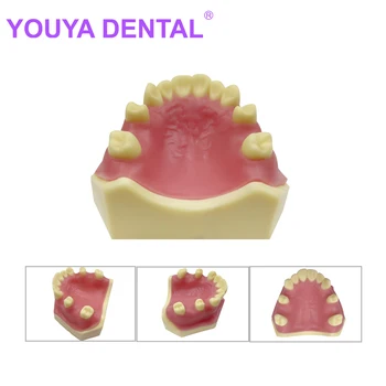 Модель зубов для имплантации, студент-стоматолог, Изучающий Обучающие модели, Стоматологическая практика, Демонстрационные инструменты Typodont, Продукты